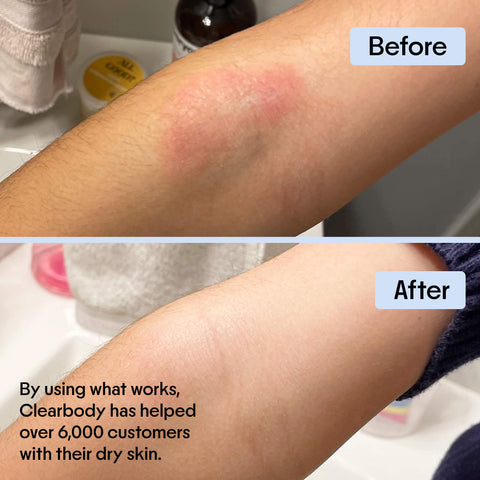 Clearbody Organics Organic Honey Eczema Cream Clearbody Organics