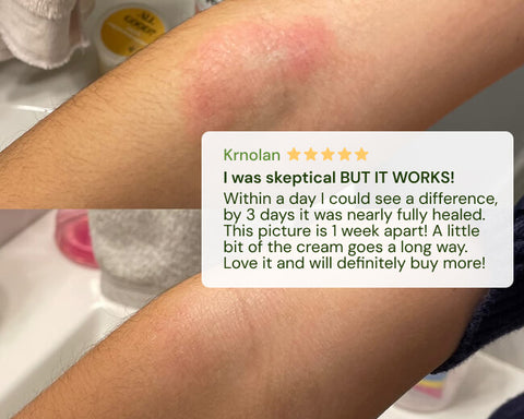 Close-up of a person's arm with a visible scratch, showing healing progress over time.